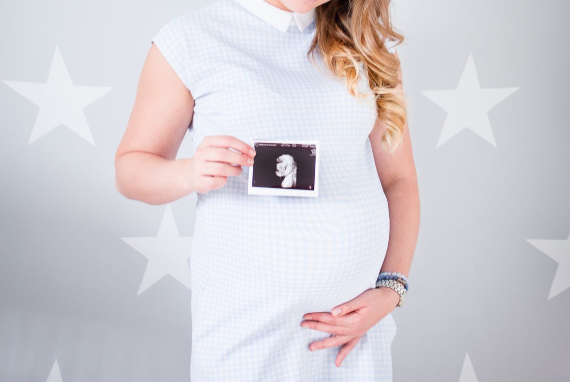 Woman Wearing White Cap-sleeved Dress Holding Ultrasound Result Photo